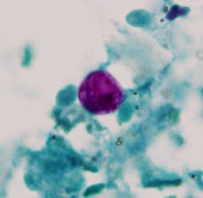 Michigan cyclospora outbreak cases eclipse 1,250