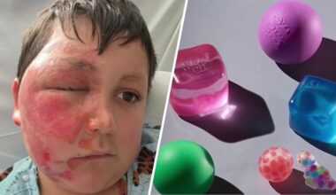Squishy toy microwave trend prompts warning after kids are burned – NBC New York