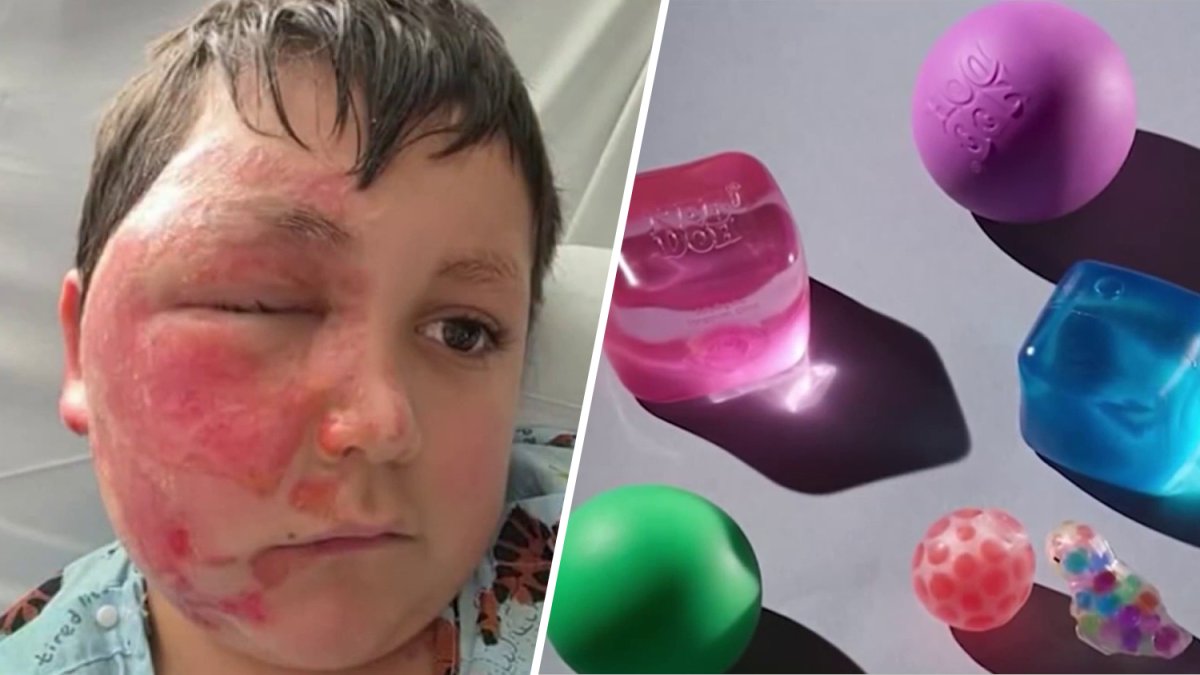 Squishy toy microwave trend prompts warning after kids are burned – NBC New York