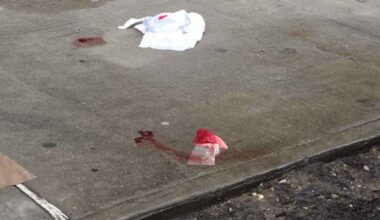 Bedford Park: Man Hospitalized after Morning Stabbing on East 198th Street after Dispute