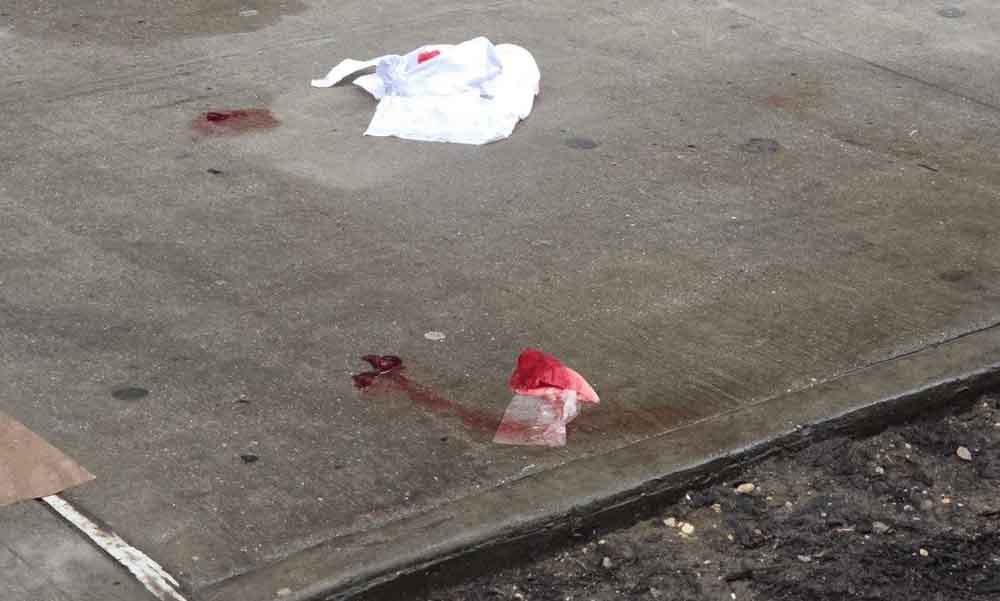 Bedford Park: Man Hospitalized after Morning Stabbing on East 198th Street after Dispute