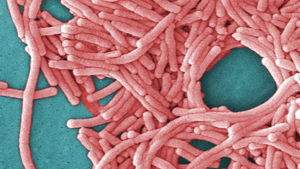 This undated image made available by the Centers for Disease Control and Prevention shows a large grouping of Legionella pneumophila bacteria (Legionnaires' disease).