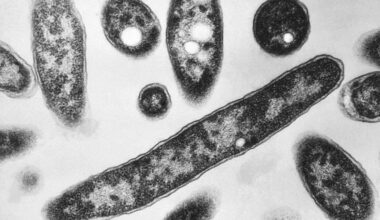 Second death reported in Legionnaires’ disease outbreak in New York City