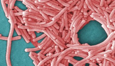 Health commissioner shares latest on Legionnaires' outbreak