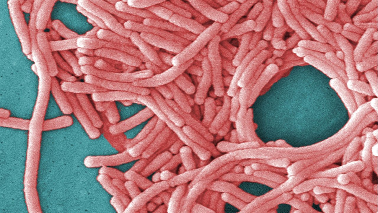 Health commissioner shares latest on Legionnaires' outbreak