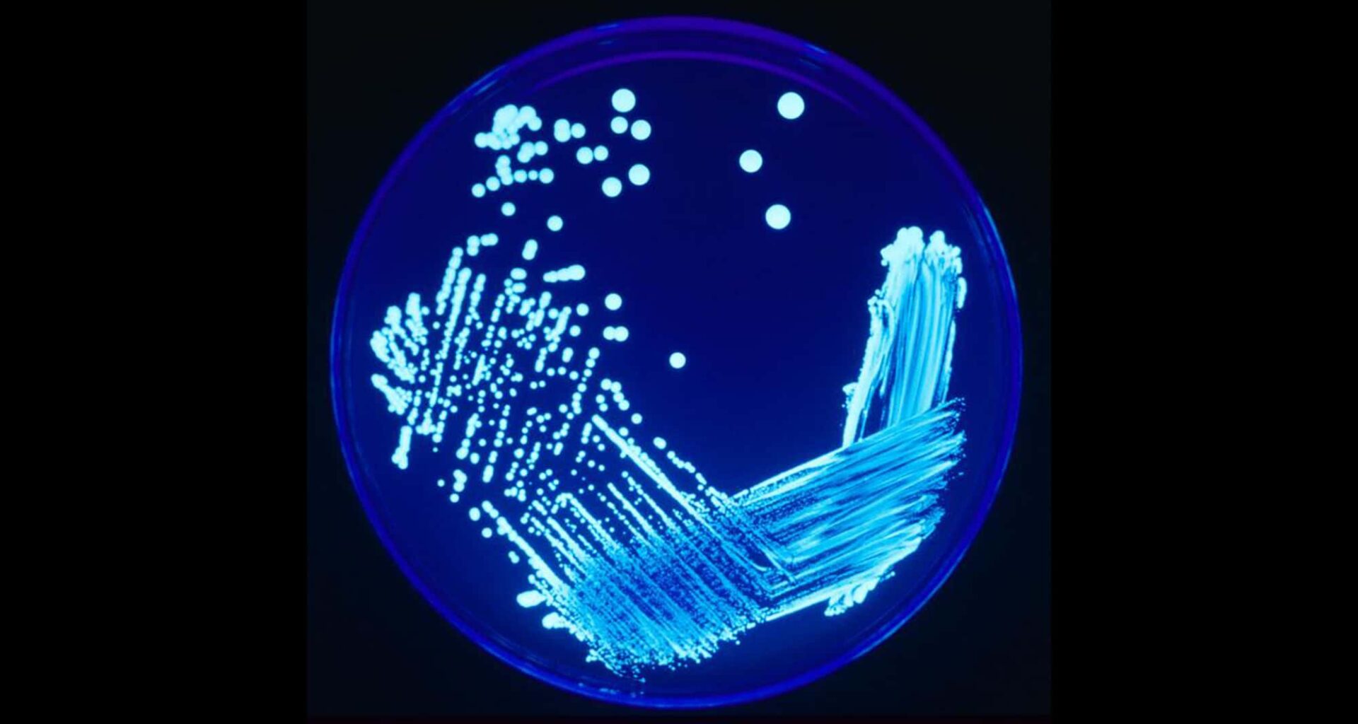 Legionnaires' Cluster Kills Five in New York City