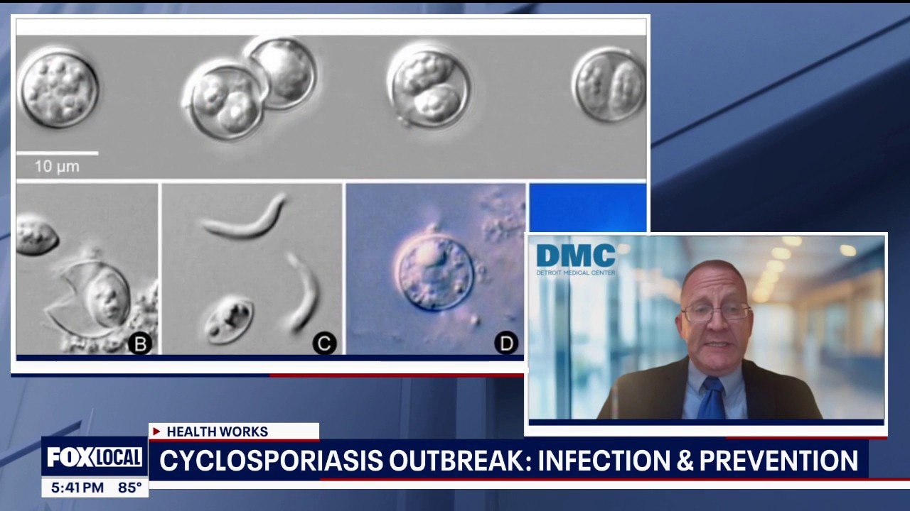 Cyclosporiasis in Michigan -- doctor explains what we need to know