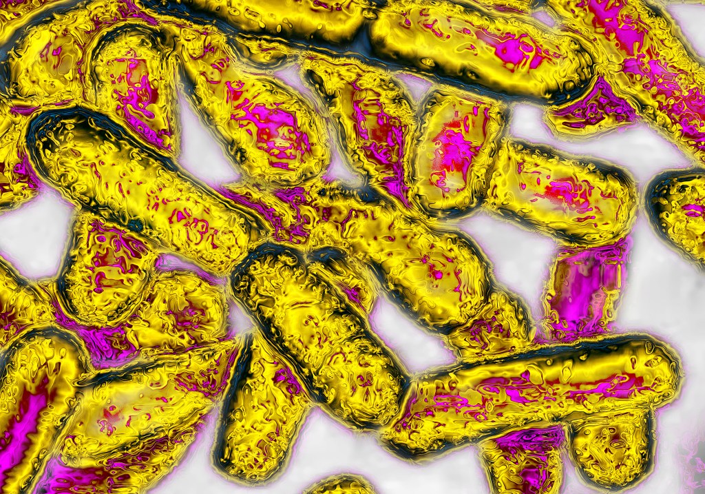 Legionella