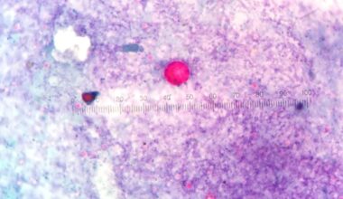 Cyclosporiasis, causing severe diarrhea, hammers New York