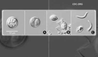NYC man spent weeks suffering from cyclosporiasis: "My body would not allow me to eat food"