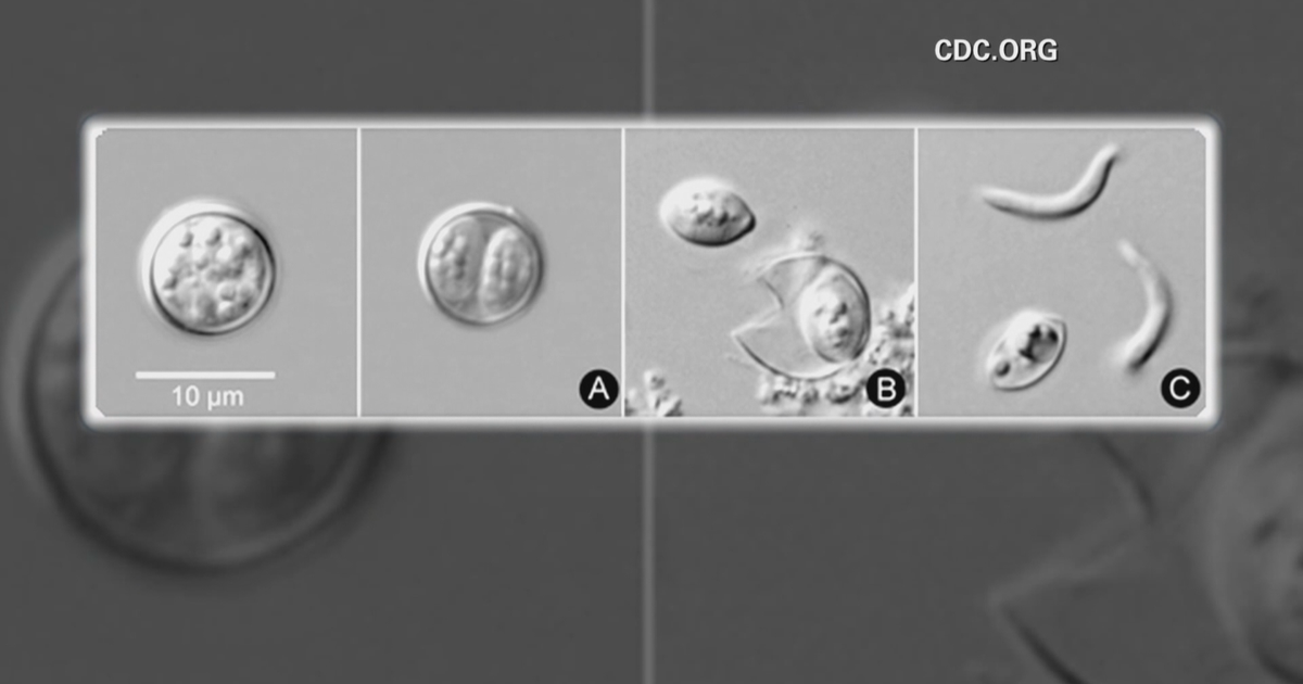 NYC man spent weeks suffering from cyclosporiasis: "My body would not allow me to eat food"