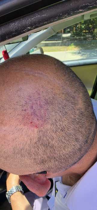 Wong's staffer suffered a head injury after allegedly being shoved to the ground during a confrontation. Police say both men had grabbed each other. Photo via Council Member Phil Wong.