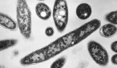 New Cases Slow in NYC Legionnaires' Disease Outbreak; Met Museum Among Buildings With Positive Tests