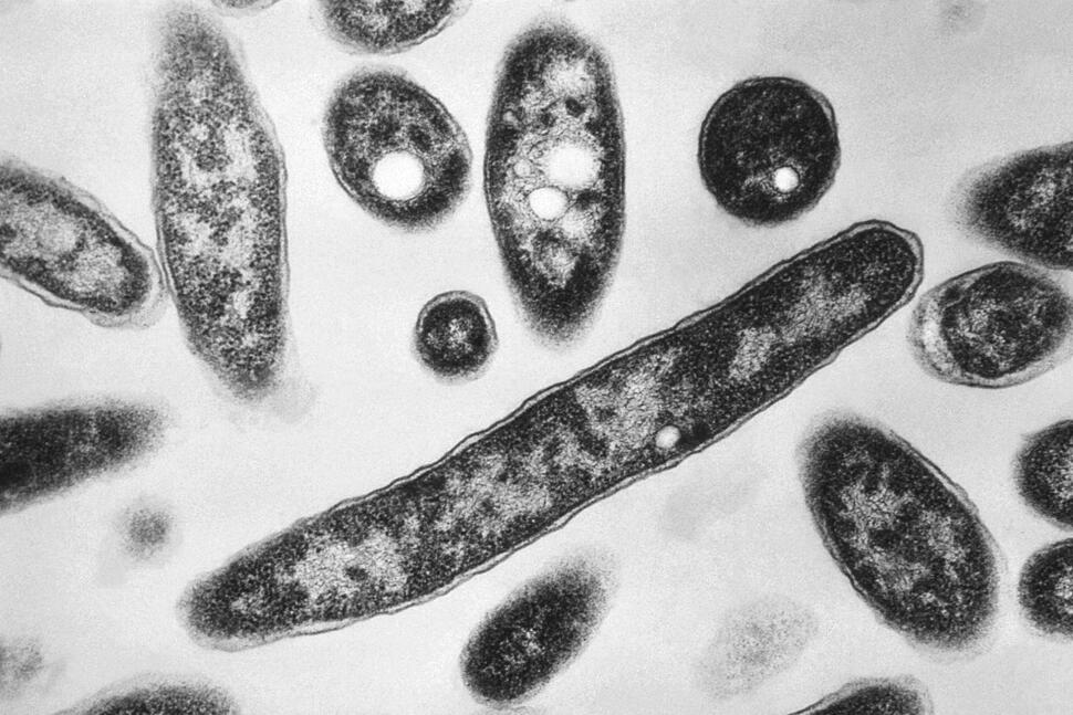 New Cases Slow in NYC Legionnaires' Disease Outbreak; Met Museum Among Buildings With Positive Tests