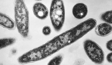 Second death reported in Legionnaires’ disease outbreak in New York City