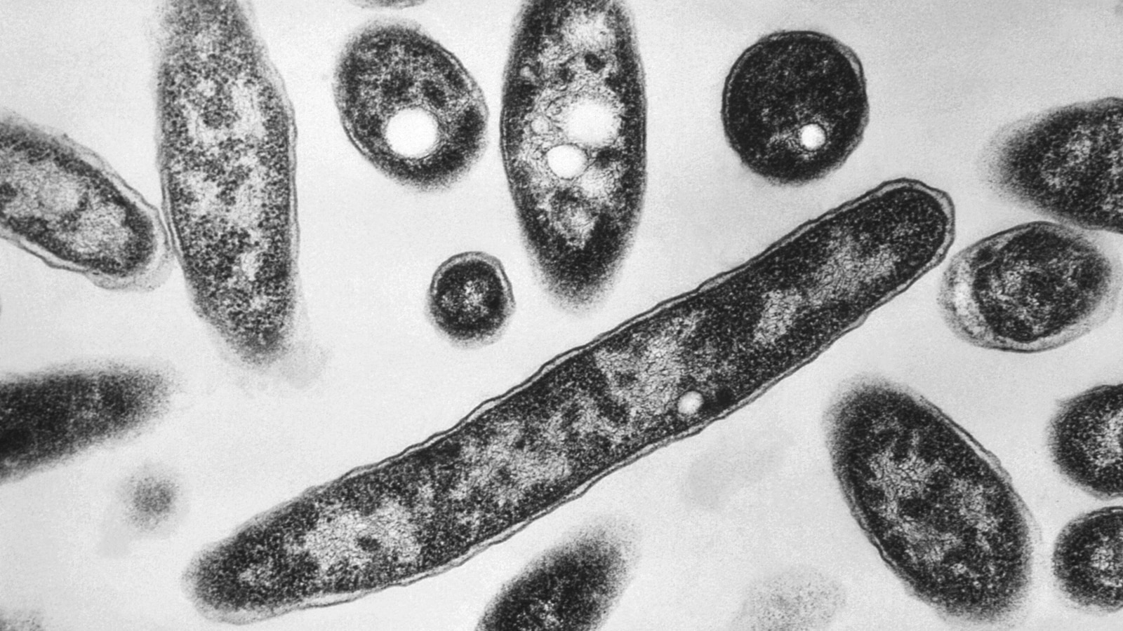 Second death reported in Legionnaires’ disease outbreak in New York City