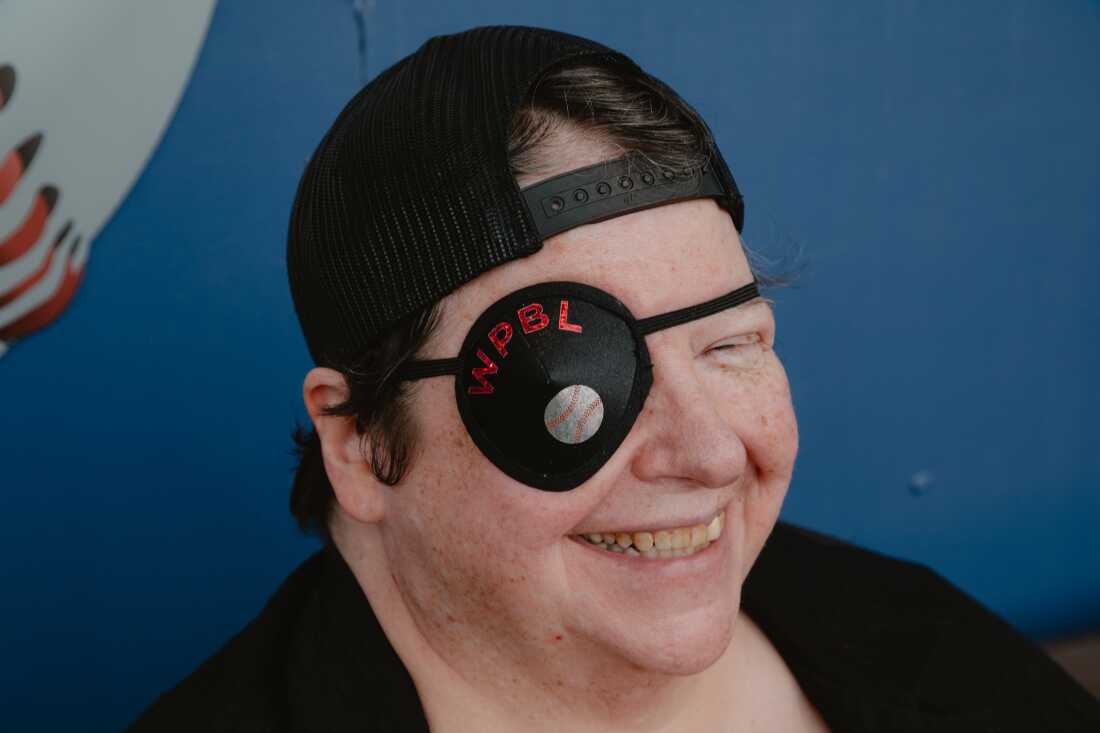 Rebecca Buchanan of Springfield, IL dons a custom-made eye patch at Opening Day of the Women's Pro Baseball League at Robin Roberts Stadium. Springfield, IL, August 2, 2026.