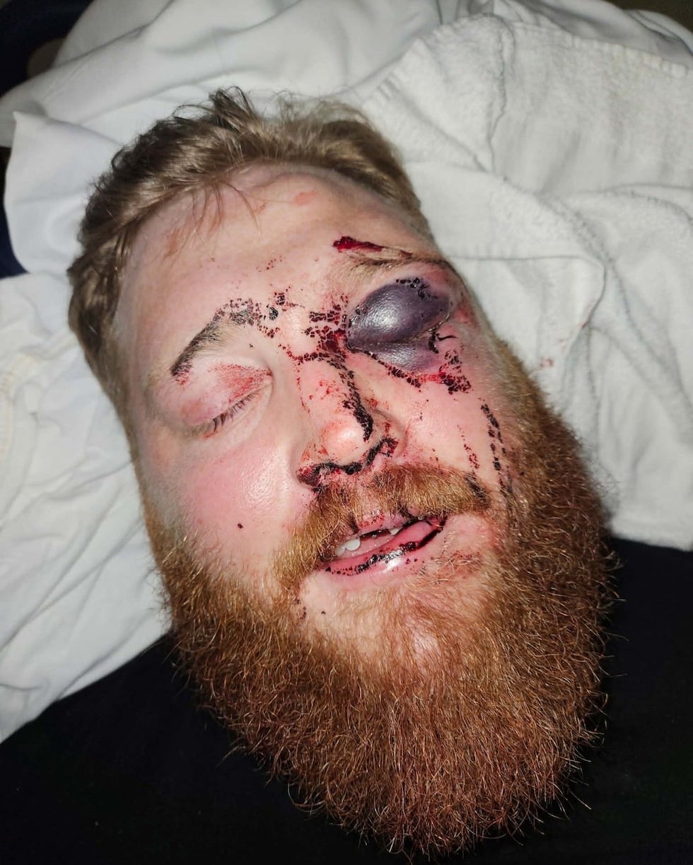 The New York State Correctional Officers & Police Benevolent Association provided this photo...