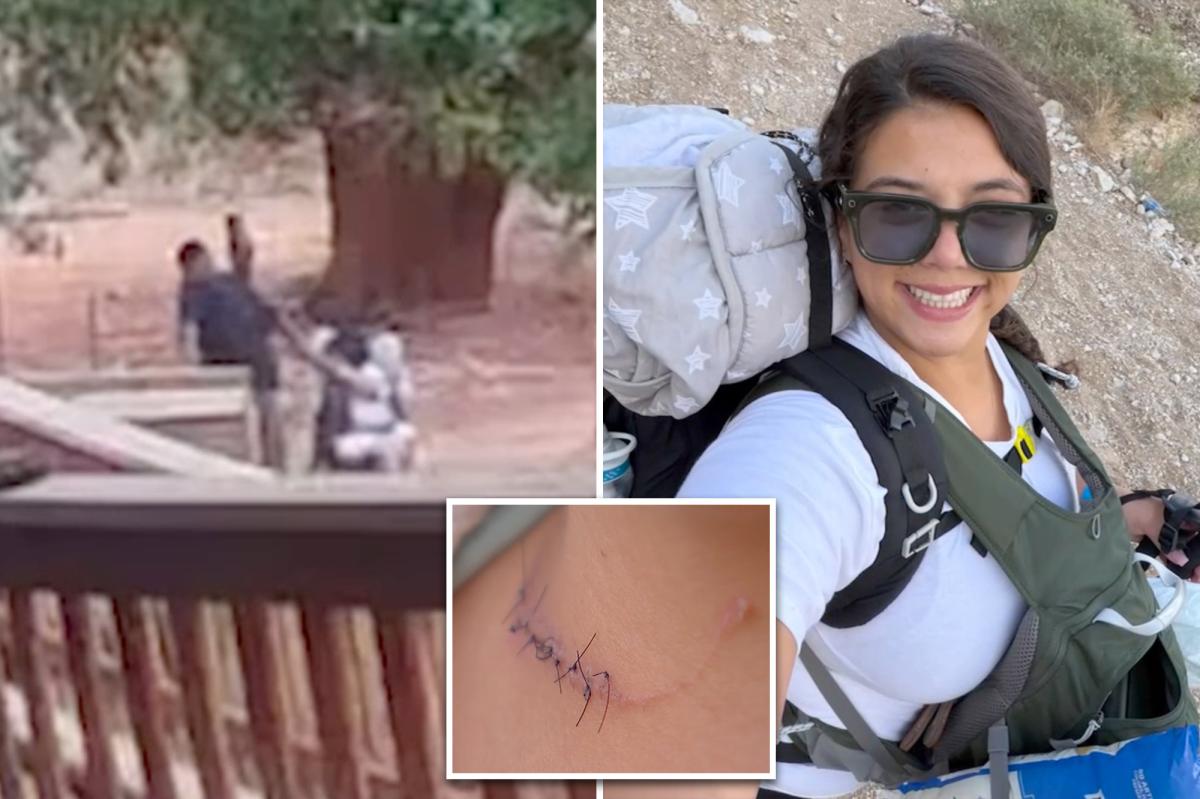 NYC mom violently slashed by ex-con during Arizona hiking trip: 'I can't die like this'