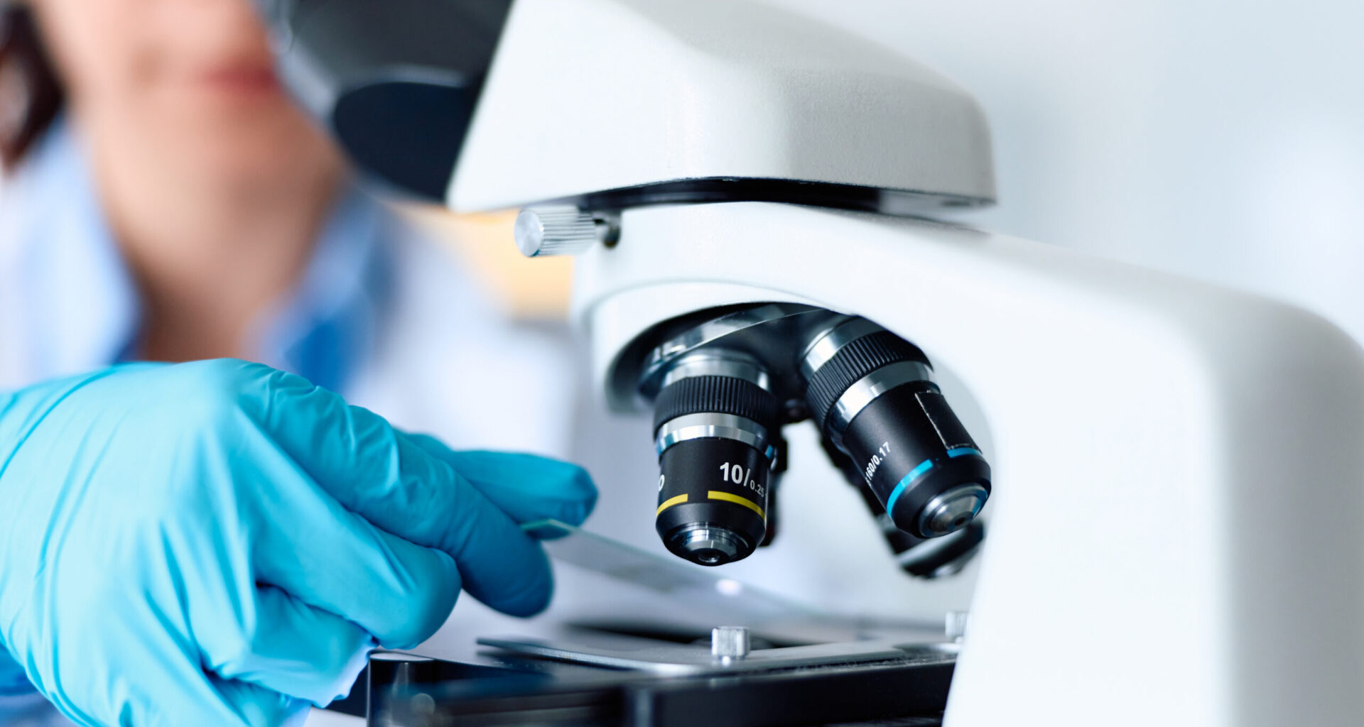 Cyclospora Case Data | Cyclosporiasis