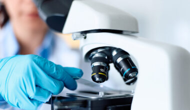 Cyclospora Case Data | Cyclosporiasis