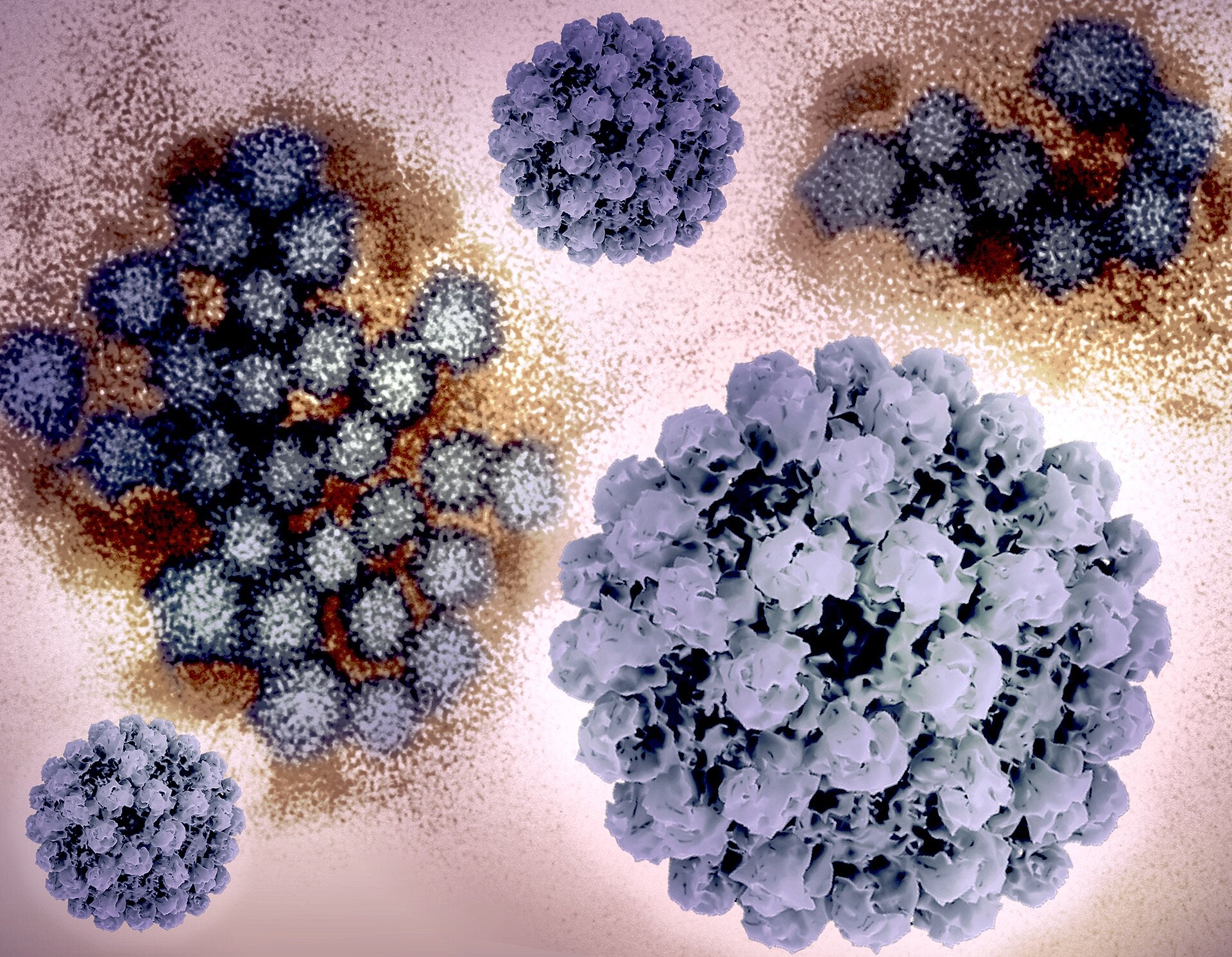 A newlywed couple's wedding reception was ground zero for more than 30 norovirus infections, according to court filings