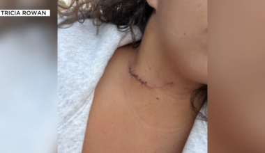 ‘Living nightmare’: New York woman’s throat cut in attack during Havasupai Falls trip