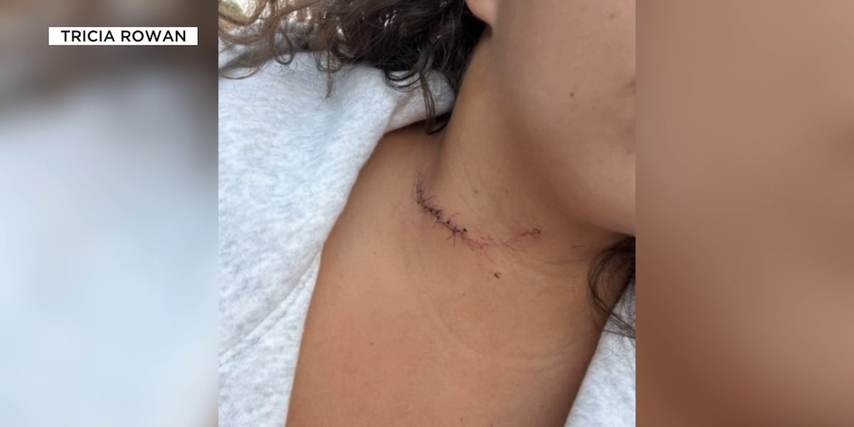 ‘Living nightmare’: New York woman’s throat cut in attack during Havasupai Falls trip
