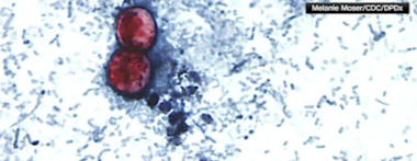 News 12 | Brooklyn | Two Deaths Linked To Cyclospora Outbreak In Michigan