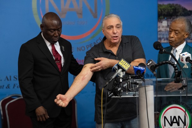 Legionnaires disease victim Nunzio Quinta shows a rash during a press conference at the National Action Network headquarters. 
