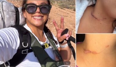 Alexis Rowan survives neck-slashing attack at Havasupai Reservation