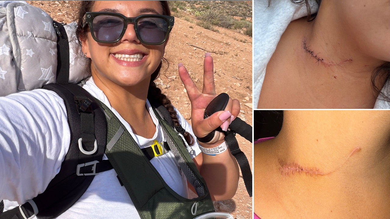 Alexis Rowan survives neck-slashing attack at Havasupai Reservation