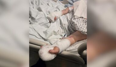 Suspect in Bronx knife attack was freed due to late paperwork, victim alleges