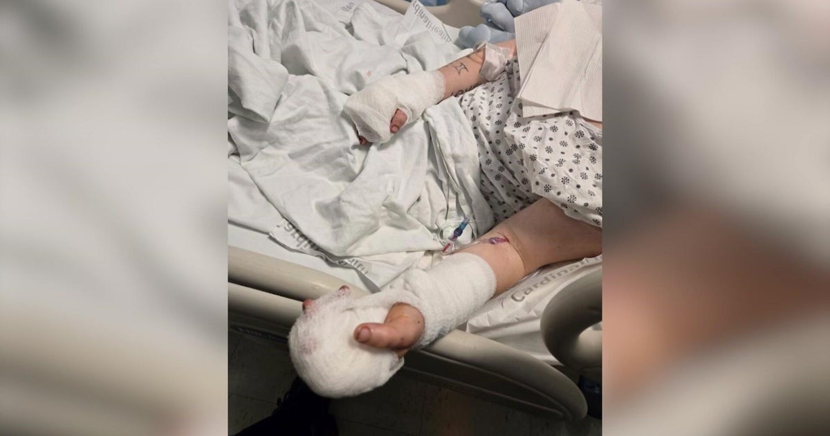 Suspect in Bronx knife attack was freed due to late paperwork, victim alleges