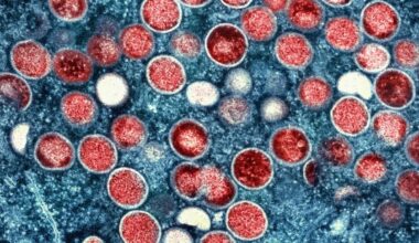 NYC reports rise in Mpox Clade I cases among travelers returning from overseas