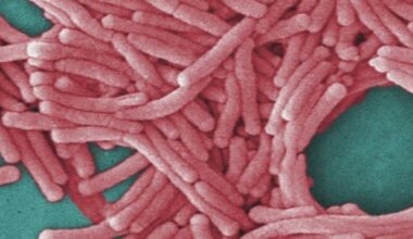 Legionnaires’ map, hotline and more could come in NYC Council bill package