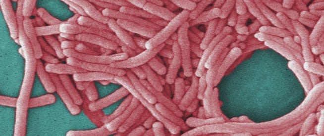 Legionnaires’ map, hotline and more could come in NYC Council bill package