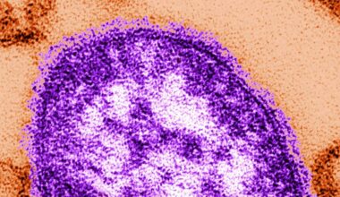 An electron microscope image of a measles virus particle