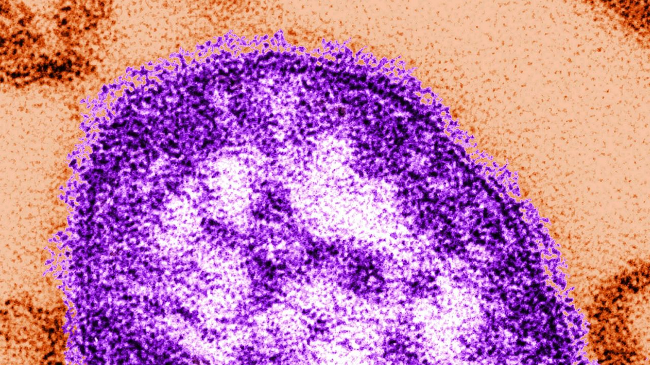 An electron microscope image of a measles virus particle