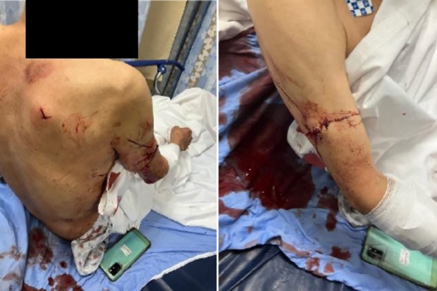 Choudhary Virk allegedly committed a string of four violent, knifepointrobberies of taxi drivers in Brooklyn and Queens in February 2023. Here, a cab driver who was stabbed multiple times, is pictured at a hospital on Feb. 25, 2023. (USDOJ / EDNY)