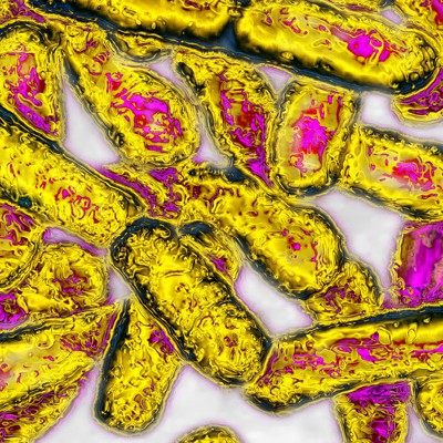 Opinion: Legionella community outbreaks are hard. Politicizing them makes them harder.