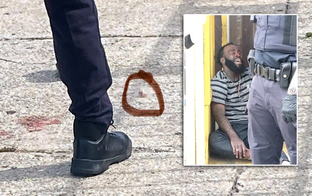 A man (inset) had his left eyeball (main) gouged out on New Lots Ave. in Brooklyn on Thursday, Sept. 3, 2026. (Photos courtesy of George Ylitao)