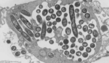 1 dead, 5 diagnosed with Legionnaires’ disease in The Bronx – NBC New York