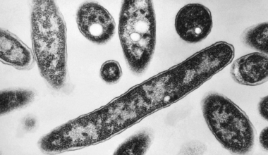 South Bronx Legionnaires’ outbreak death toll rises to 2