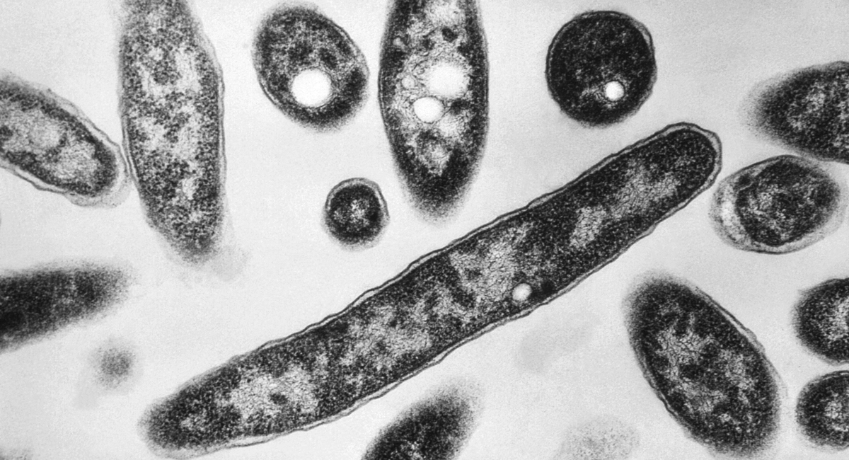 South Bronx Legionnaires’ outbreak death toll rises to 2