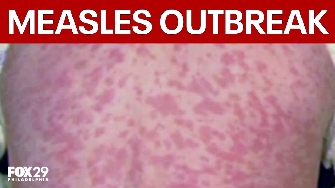 Pennsylvania measles deaths climb to 4 
