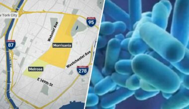 Bronx buildings with live Legionella released: Full list here – NBC New York
