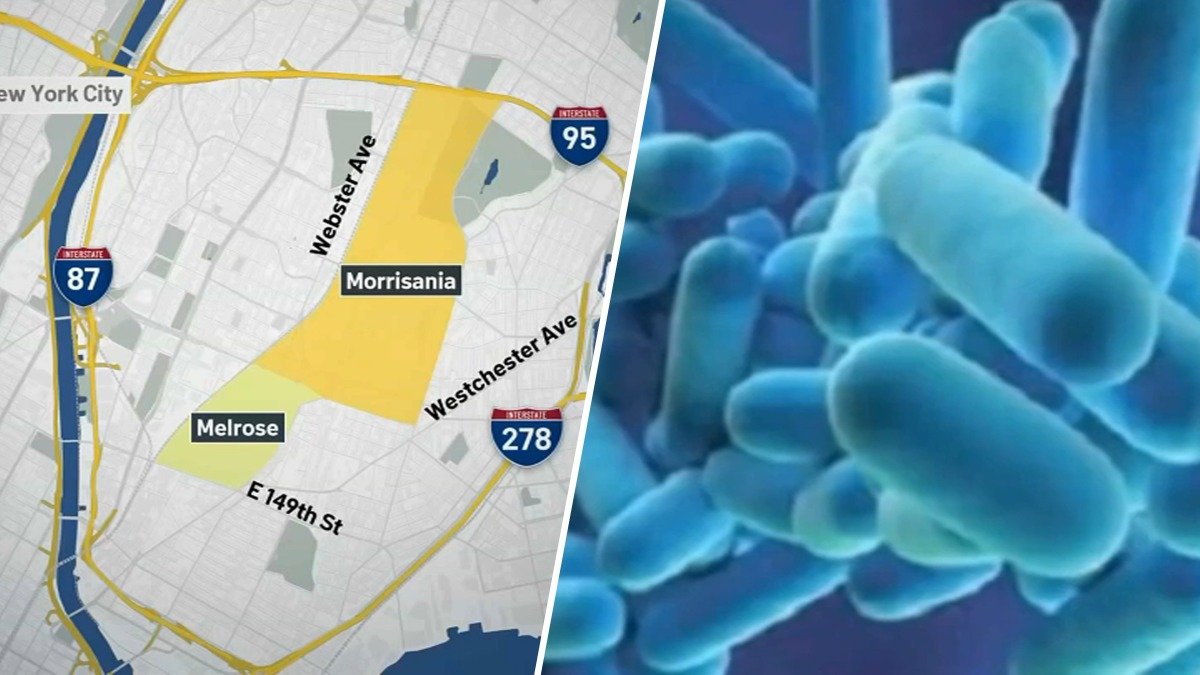 Bronx buildings with live Legionella released: Full list here – NBC New York