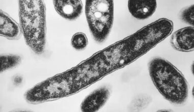 NYC Council to scrutinize city's response to Legionnaires' cluster linked to 94 cases