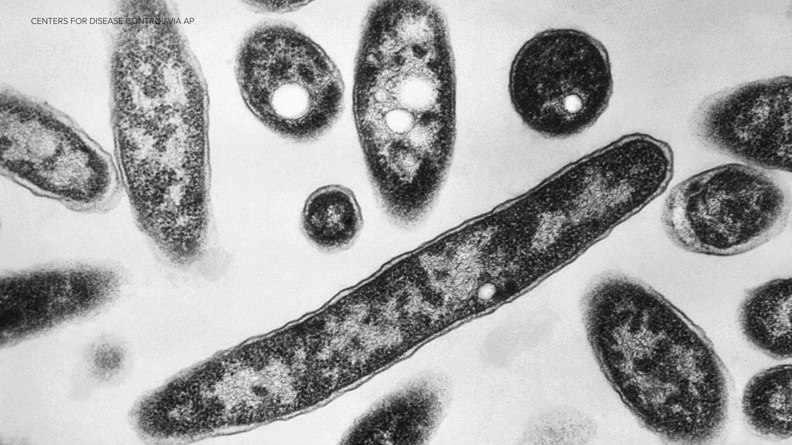 Legionnaires' disease Bronx cluster: 1 death, 5 cases reported by the NYC Health Department